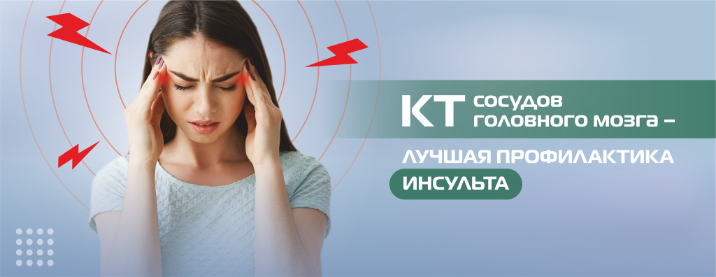 КТ - сосуды головного мозга.png